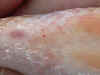 damage on koi from costia